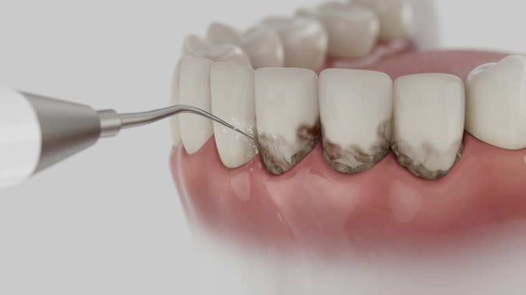 Reliable Dental contractor in Brownfield, TX by Smile Center Dentistry